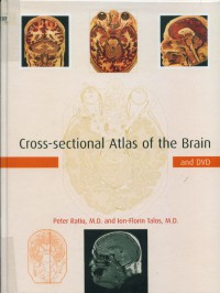 Cross-sectional atlas of the brain