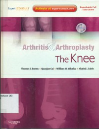 Arthritis & Arthroplasty : the knee