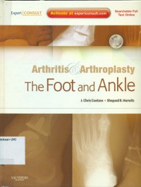 Arthritis & Arthroplasty : the foot and ankle