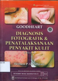Image of [Goodheart's Photoguide to common skin disorders: Diagnosis and Management. Bahasa Indonesia] Goodheart Diagnosis Fotografik dan Penatalaksanaan Penyakit Kulit, Edisi 3
