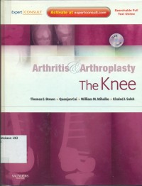 Image of Arthritis & Arthroplasty : the knee