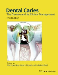 Image of Dental Caries : The disease and its clinical management