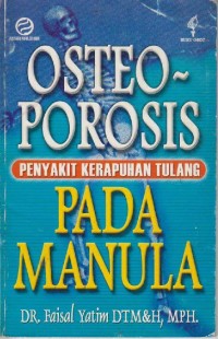 Image of Osteoporosis (penyakit Kerapuhan Tulang) pada Manula